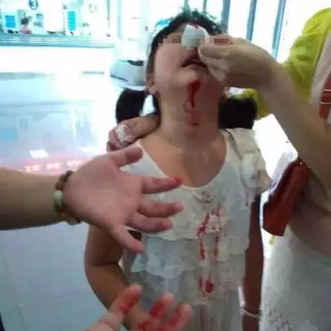 挤脑门痧现象新解析，图片背后的数据真相